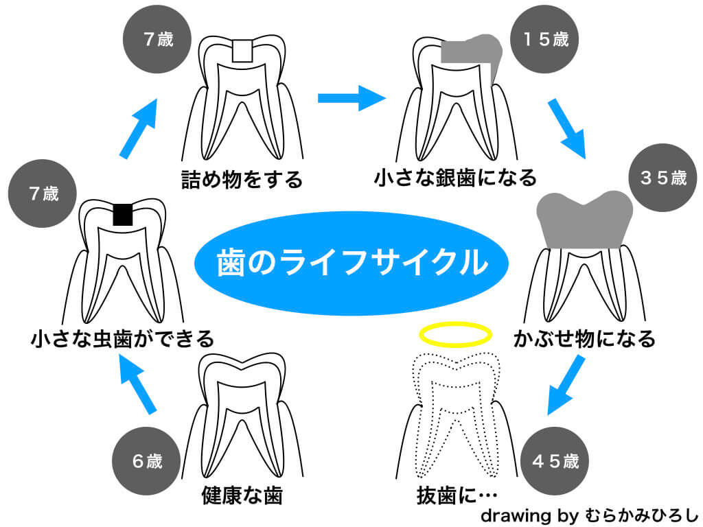 歯のライフサイクル図解